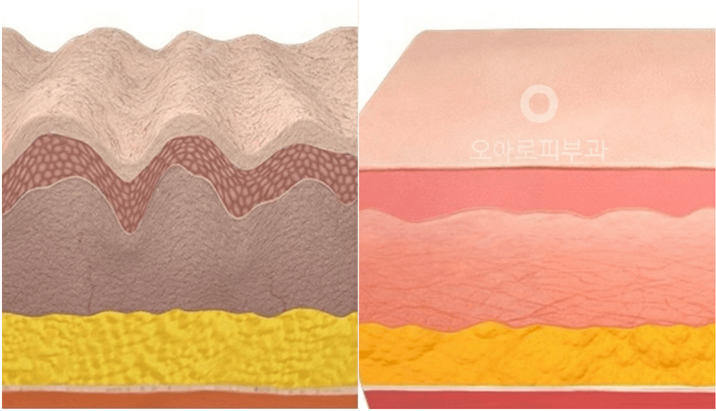 시술 전 / 시술 후